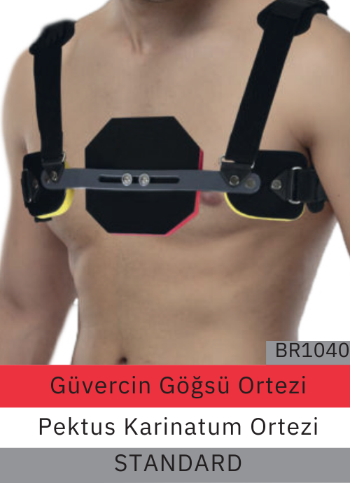 Güvercin GoğsüOrtezi br1040 Standard